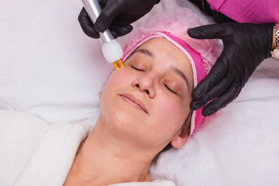 Microneedling in Stillwater, OK by Pure Skin and Aesthetics, LLC