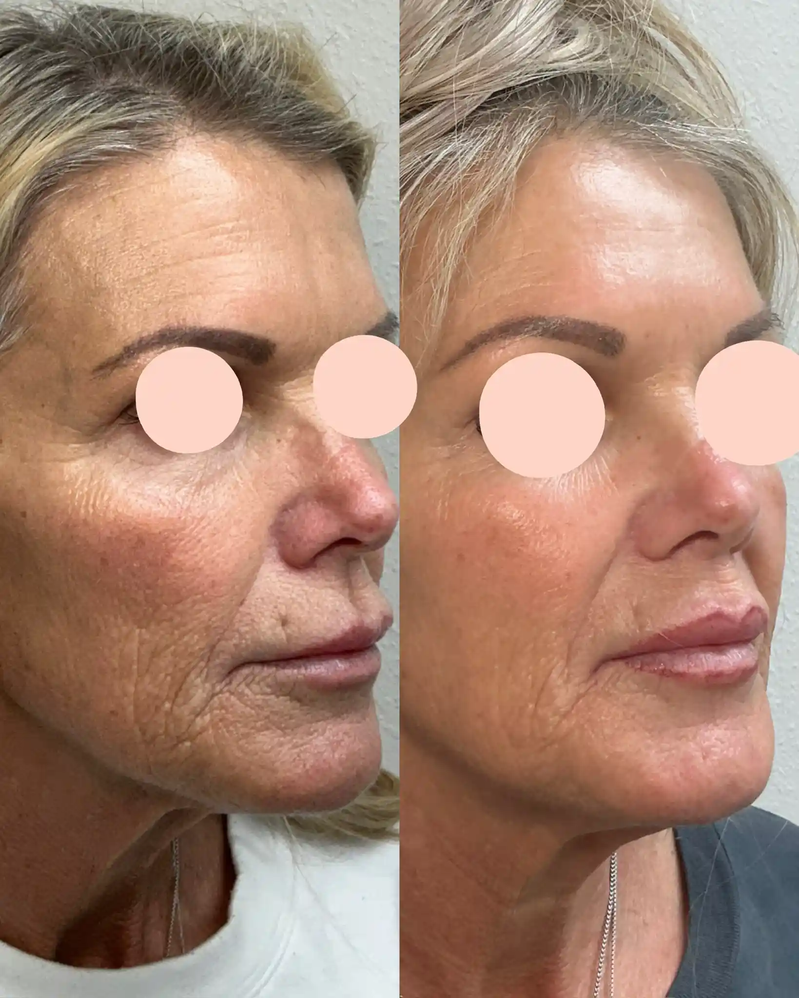 EZ Gel_Regenerative C-Pure Skin and Aesthetics in-Stillwater-OK