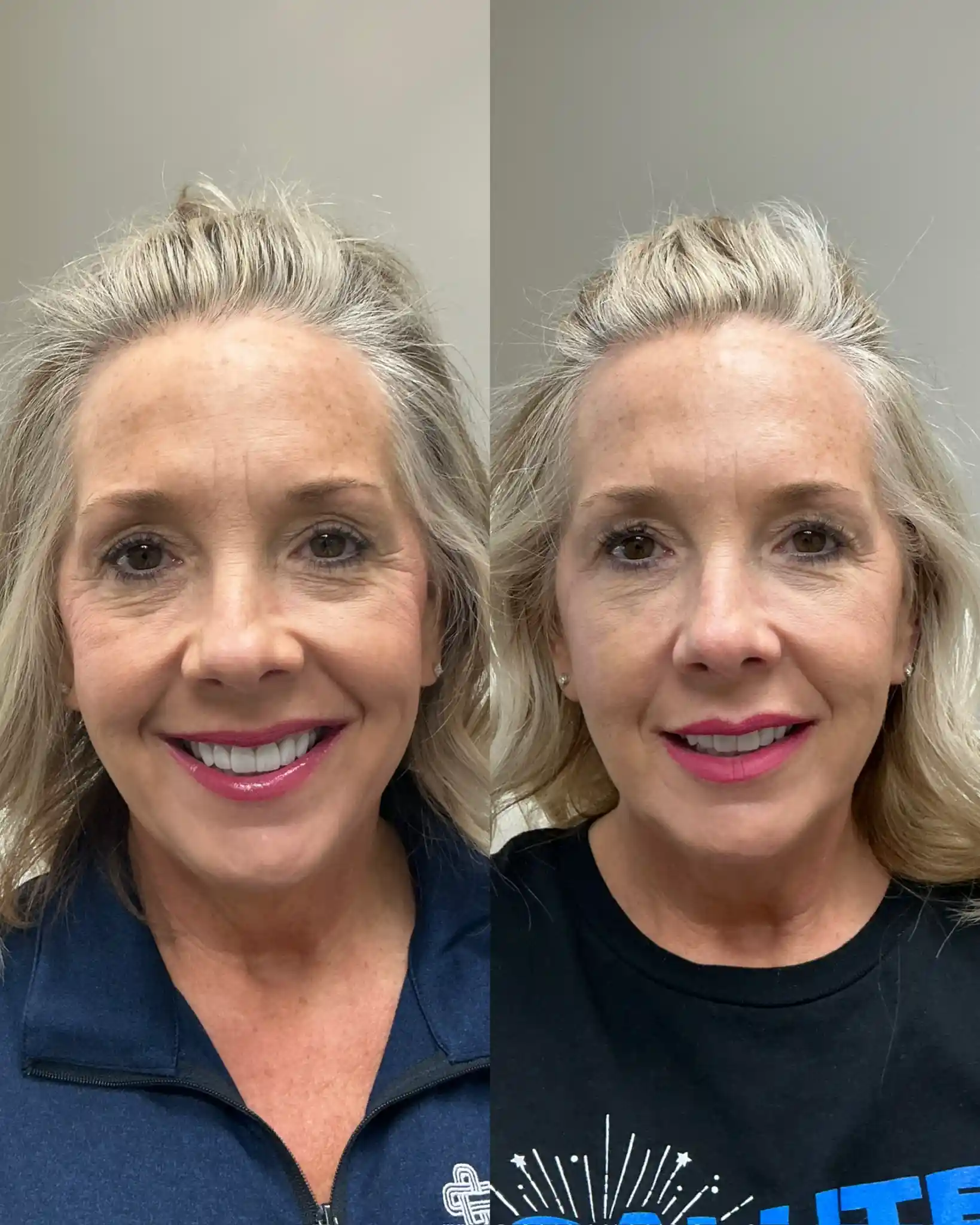 EZ Gel_Regenerative D-Pure Skin and Aesthetics in-Stillwater-OK