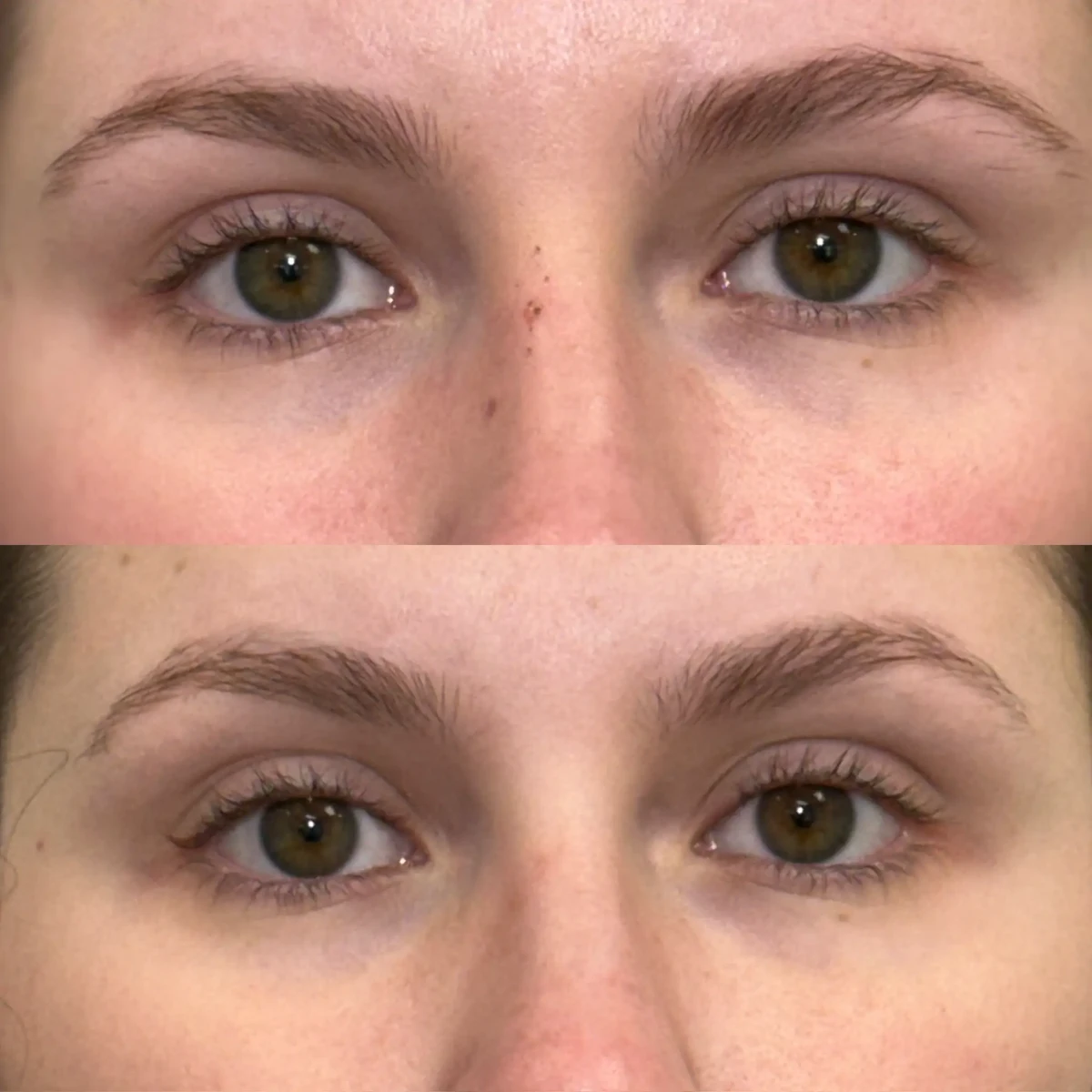 EZ Gel_Regenerative E-Pure Skin and Aesthetics in-Stillwater-OK
