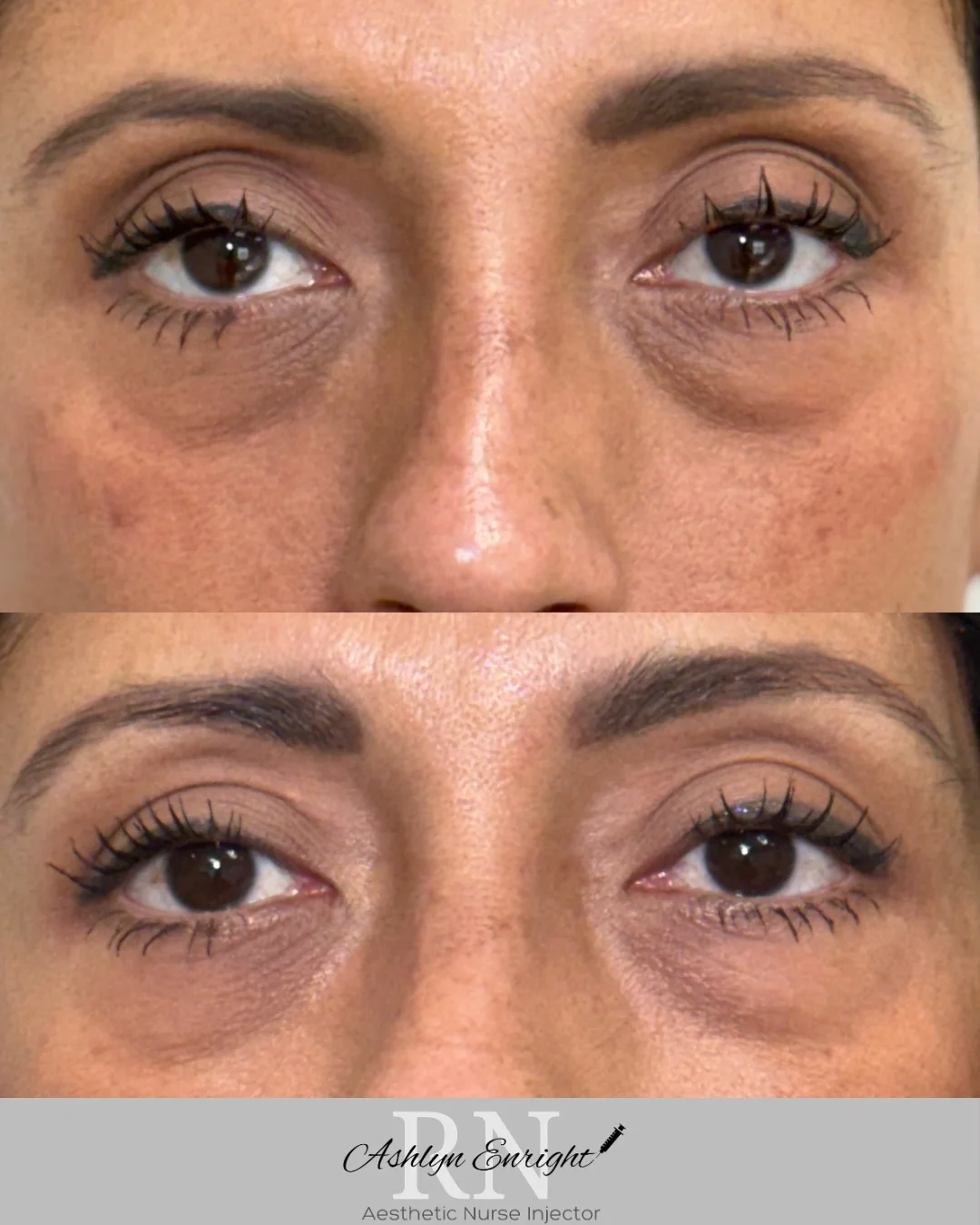 EZ Gel_Regenerative F-Pure Skin and Aesthetics in-Stillwater-OK