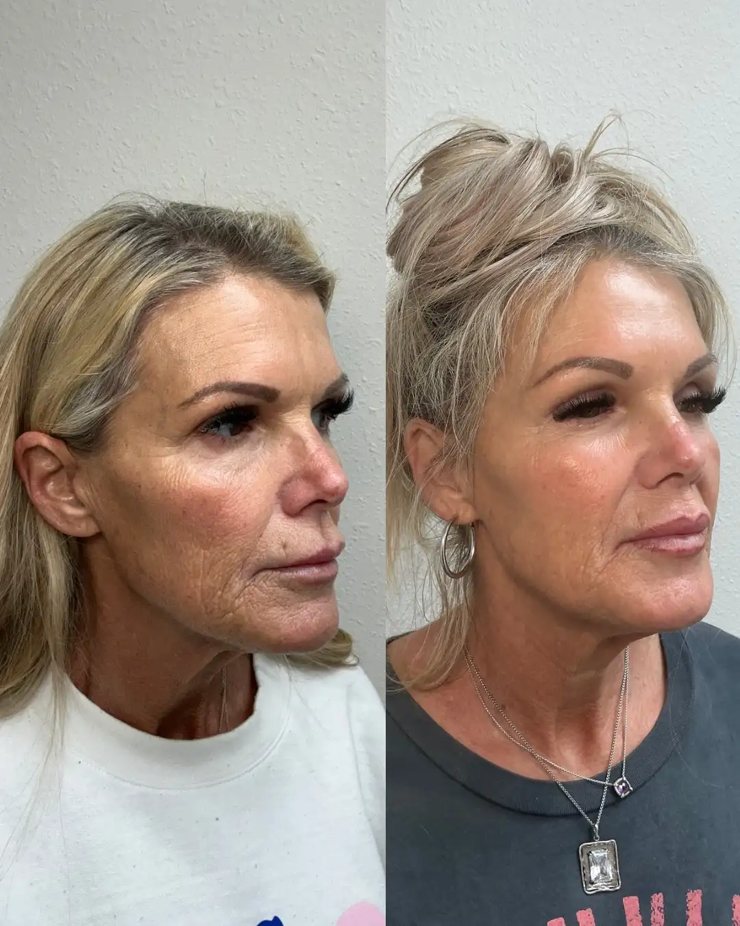 EZ Gel_Regenerative G-Pure Skin and Aesthetics in-Stillwater-OK