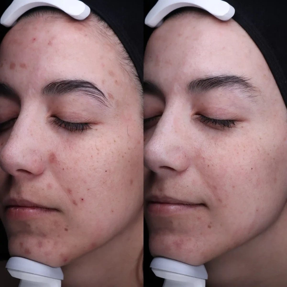 Skin B-Pure Skin and Aesthetics in-Stillwater-OK