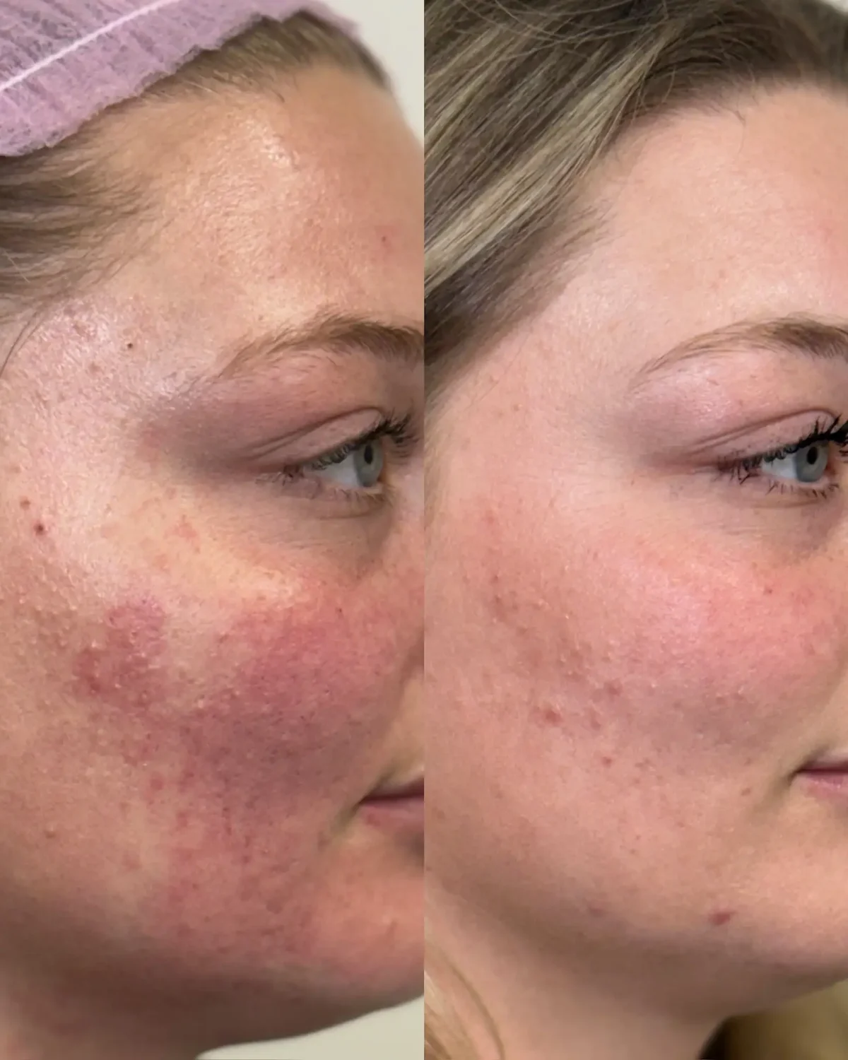 Skin H-Pure Skin and Aesthetics in-Stillwater-OK