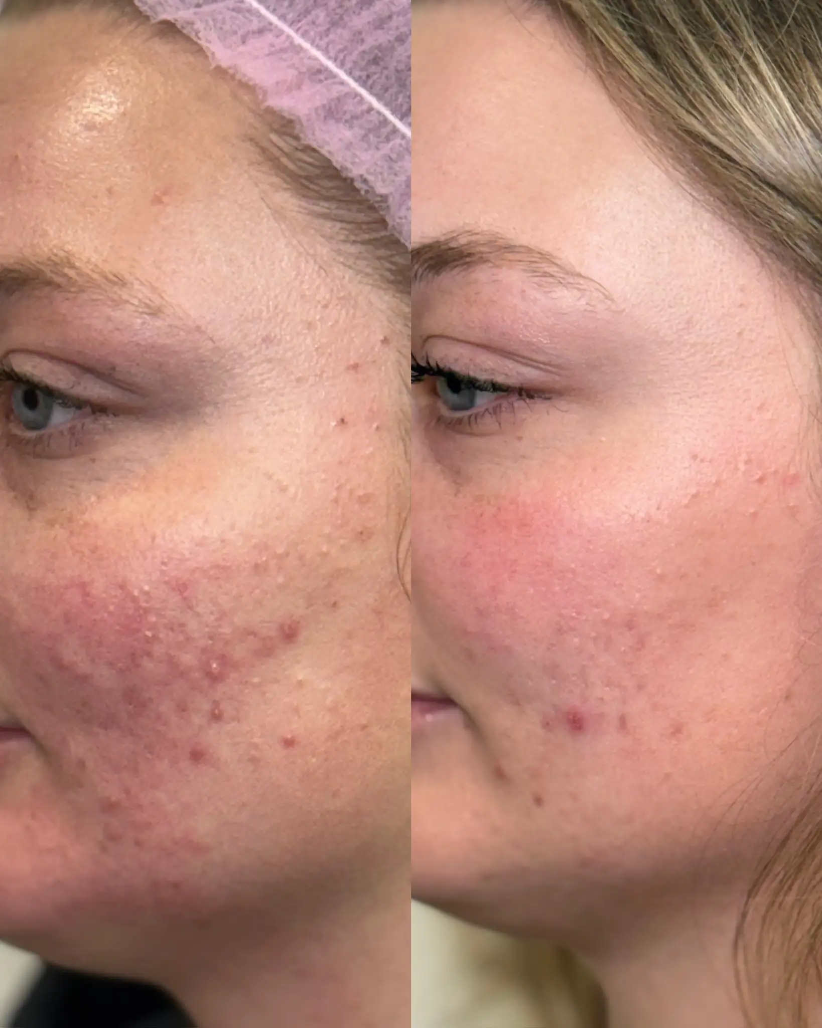 Skin I-Pure Skin and Aesthetics in-Stillwater-OK