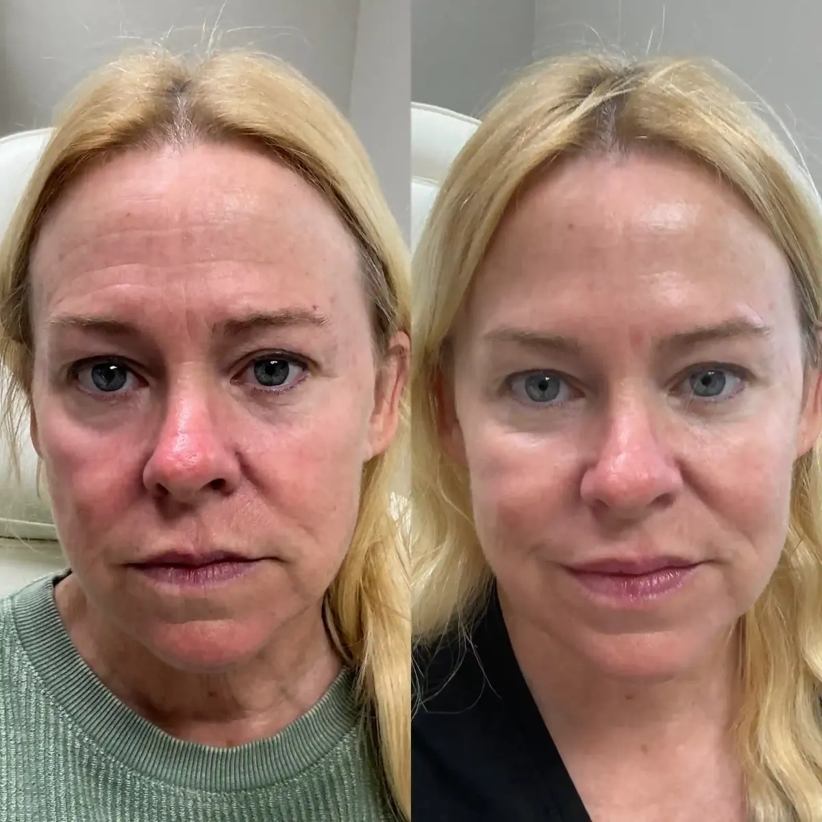 Skin c-Pure Skin and Aesthetics in-Stillwater-OK