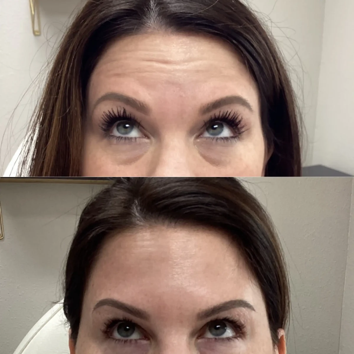 Wrinkle Relaxers e-Pure Skin and Aesthetics in-Stillwater-OK