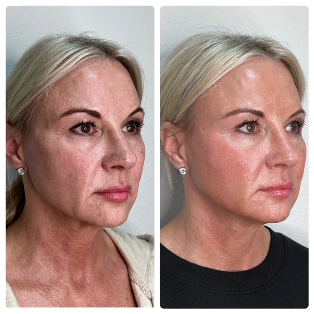 Pure Skin and AestheticsTHREADS Ain-Stillwater-OK