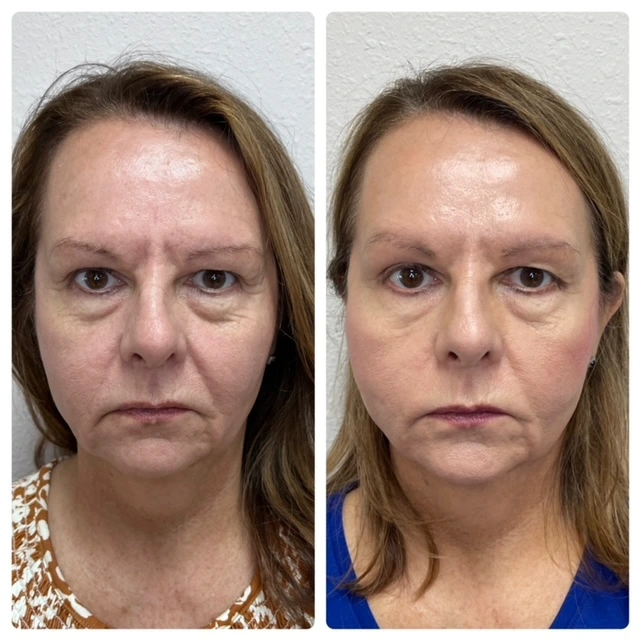 Pure Skin and AestheticsTHREADS din-Stillwater-OK