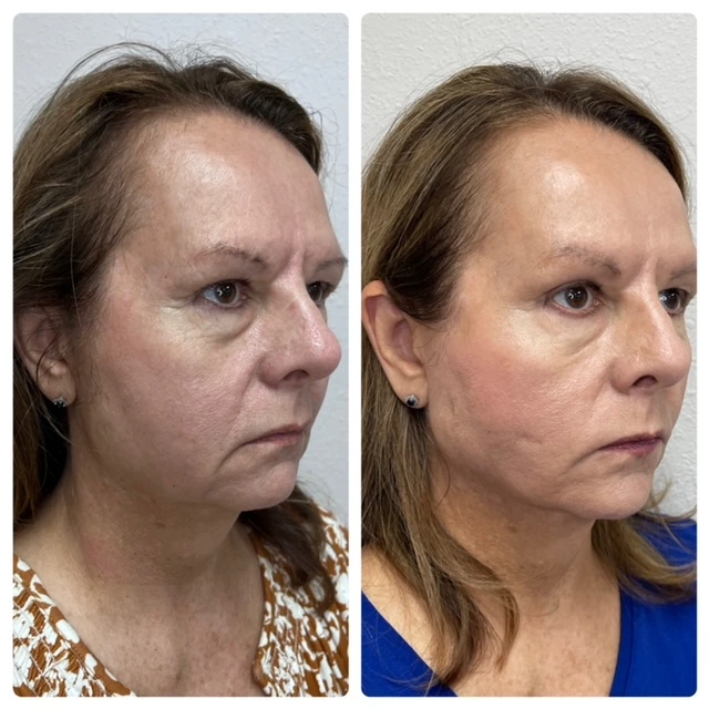 Pure Skin and AestheticsTHREADS ein-Stillwater-OK