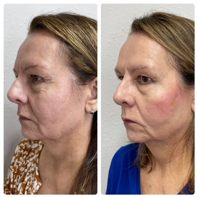 Pure Skin and AestheticsTHREADS fin-Stillwater-OK
