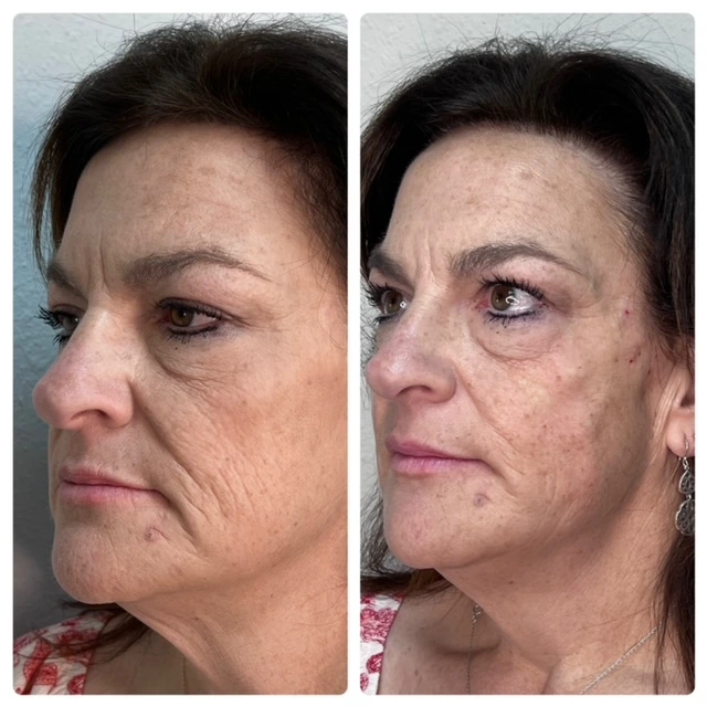 Pure Skin and AestheticsTHREADS kin-Stillwater-OK