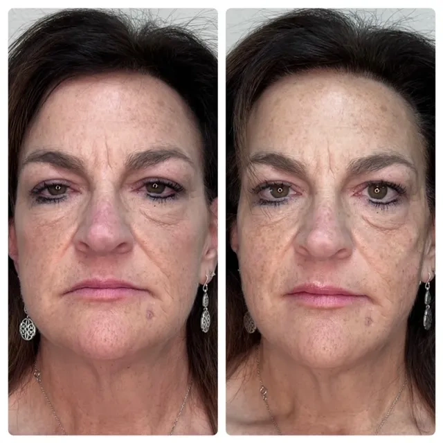 Pure Skin and AestheticsTHREADS lin-Stillwater-OK