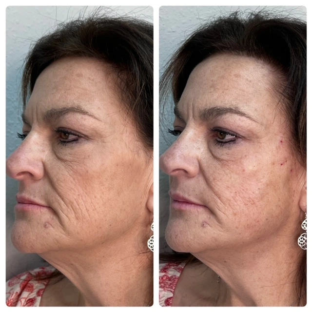 Pure Skin and AestheticsTHREADS min-Stillwater-OK
