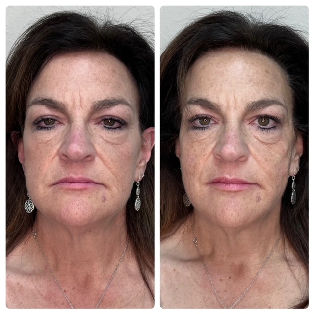 Pure Skin and AestheticsTHREADS nin-Stillwater-OK