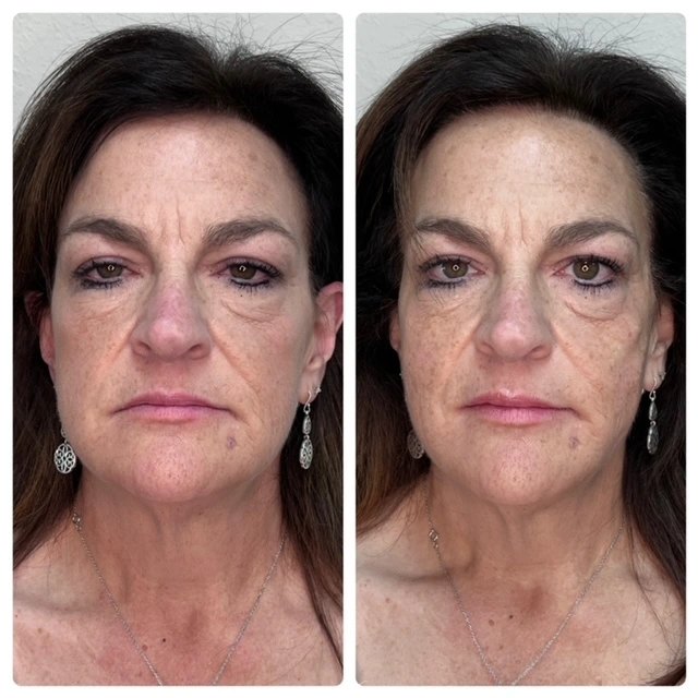 Pure Skin and AestheticsTHREADS oin-Stillwater-OK