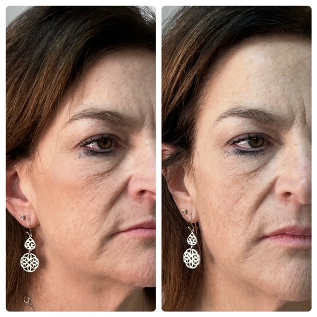 Pure Skin and AestheticsTHREADS pin-Stillwater-OK