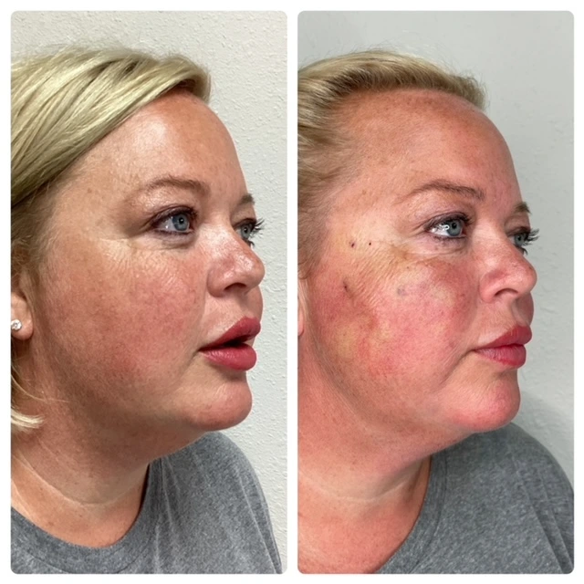 Pure Skin and AestheticsTHREADS qin-Stillwater-OK