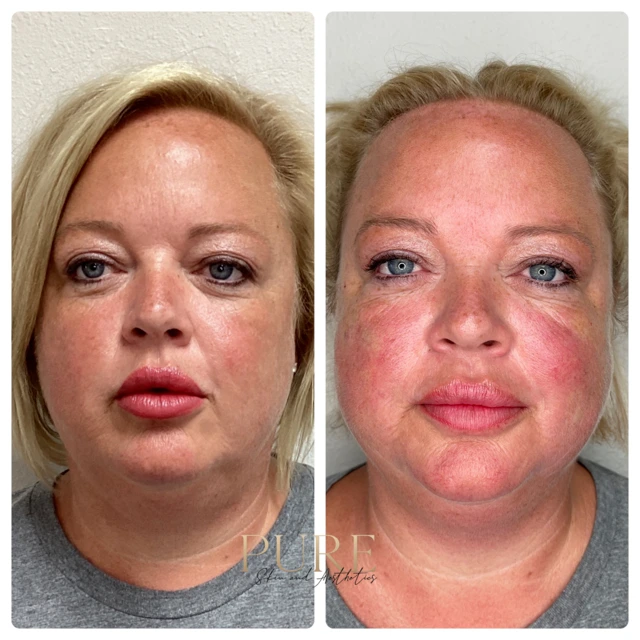 Pure Skin and AestheticsTHREADS rin-Stillwater-OK