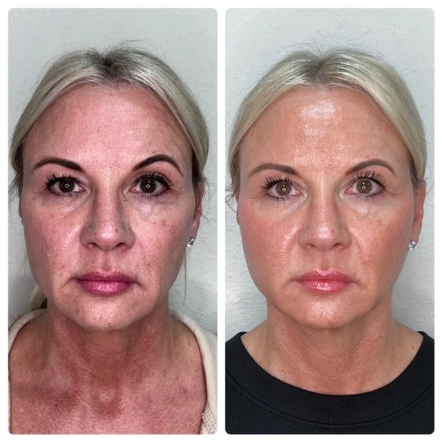 Pure Skin and AestheticsTHREADSin-Stillwater-OK